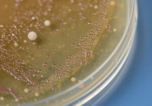 Microorganismos patógenos